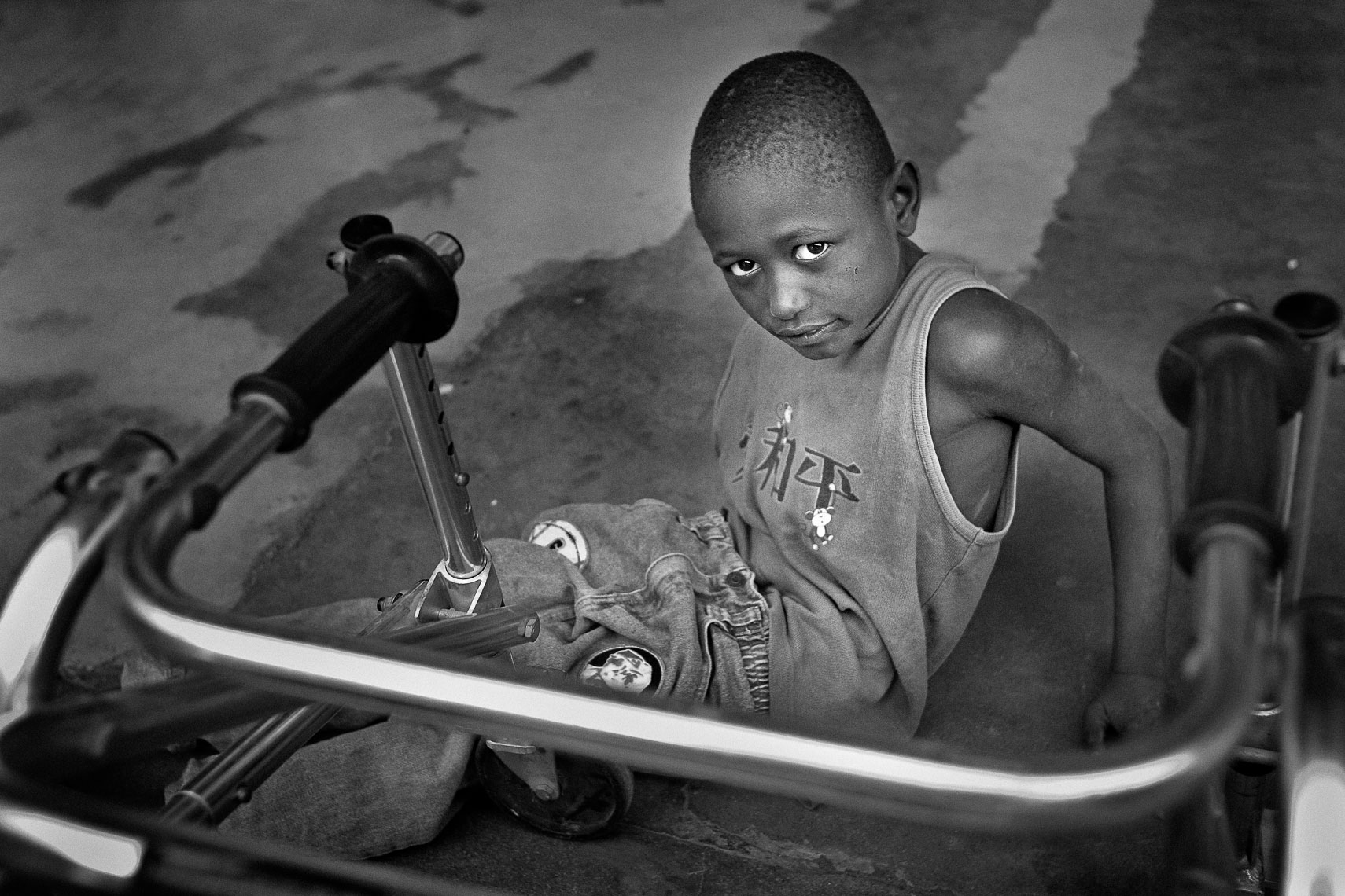spinal tuberculosis child victim patient house of hope orphanage la pointe port de paix haiti